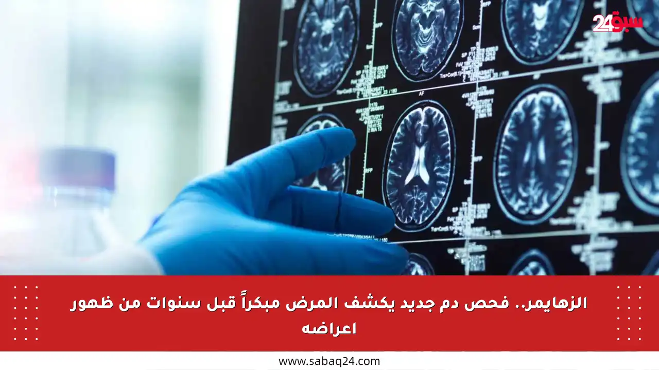 الزهايمر.. فحص دم جديد يكشف المرض مبكراً قبل سنوات من ظهور أعراضه